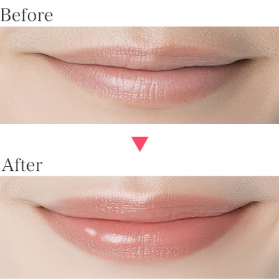 リップアディクトのビフォーアフター