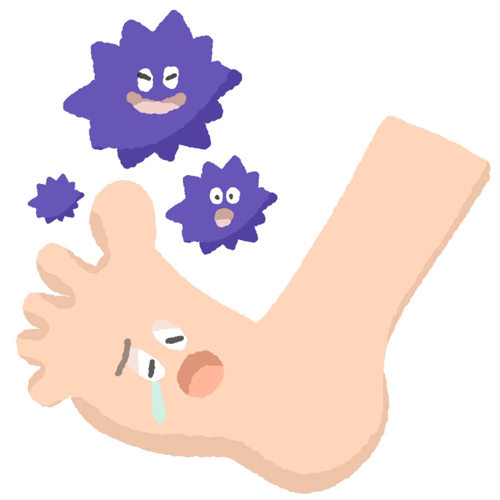 かかと・足裏・指の間…水虫のサインチェック